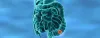 Why is Colorectal Cancer Incidence Rising in the Young?