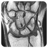 Wrist injury treatment in Mumbai - Dr. Pranjal Kodkani