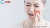 Emergency Dental Service in Mountainville | Emergency Dental Service