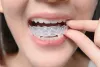 Your Child Needs Straight Teeth, Consider 4 Types of Braces