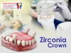  What to Expect When Going for a Zirconia Crown Procedure?          |          smiles-N-aesthetics 