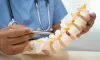 early-signs-of-ankylosing-spondylitis-the-physio-experts_0.png