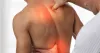 back-treatment.jpg
