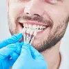 dental_veneers_deception_bay.jpg