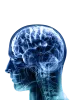 new-x-ray.png