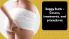 saggy_butts_-_causes_treatments_and_procedures.png