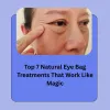 top-7-natural-eye-bag-treatments-.jpg