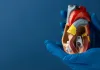 trans_catheter_aortic_valve_replacement_1.jpg