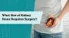 what_size_of_kidney_stone_requires_surgery.png