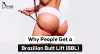 why-people-get-a-brazilian-butt-lift-bbl.jpeg